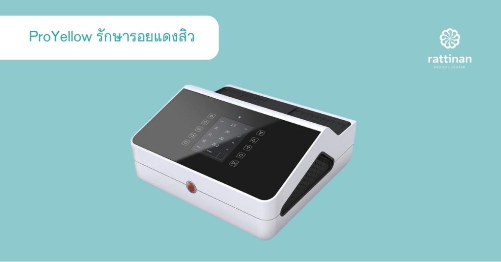 เลเซอร์ลดรอยแดงสิว